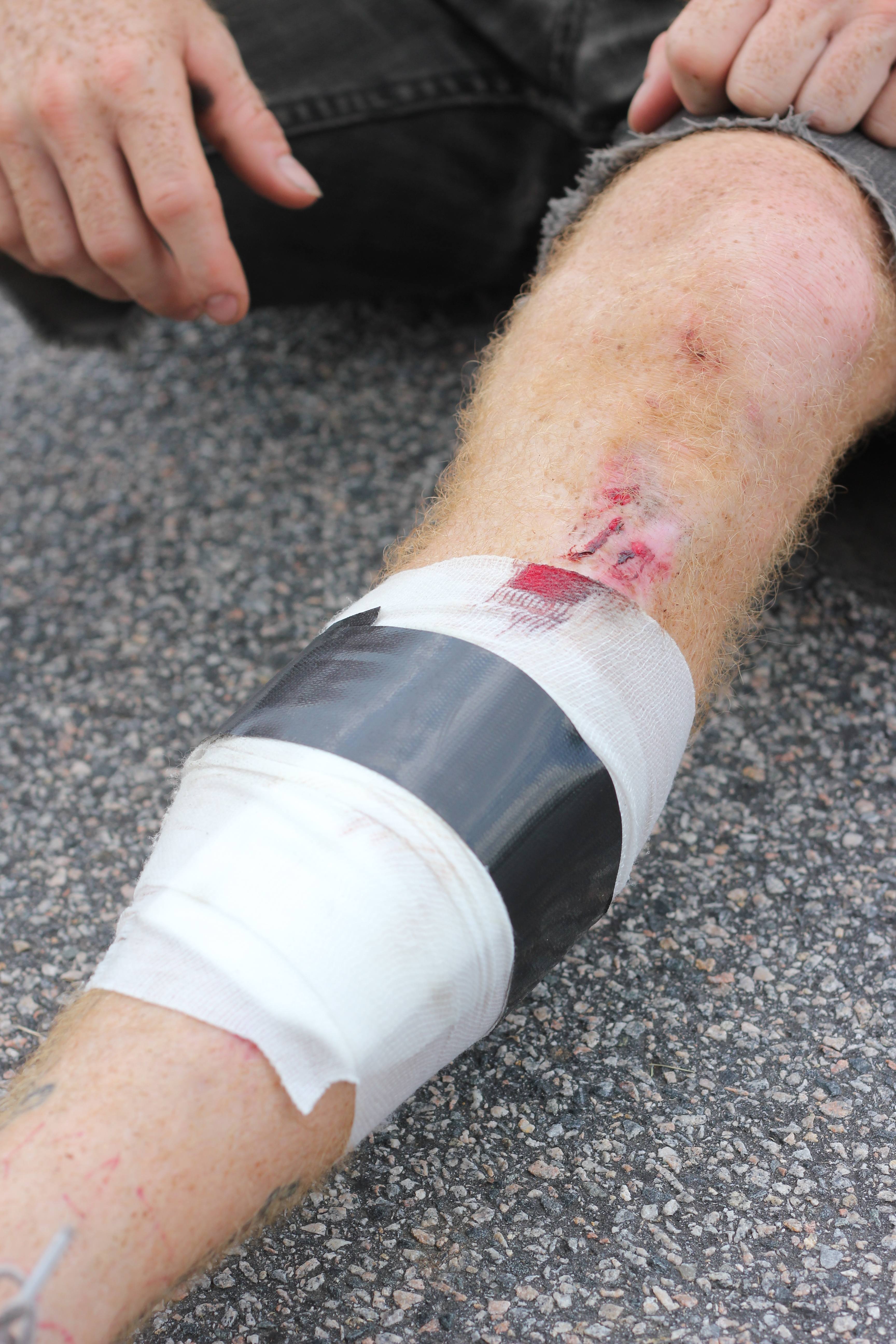 Mark Leg